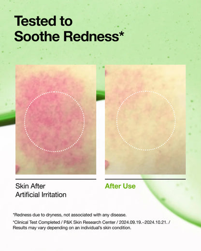 Azelaic Acid 10 Hyaluron Redness Soothing Serum